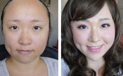 Cách làm mũi cao 6