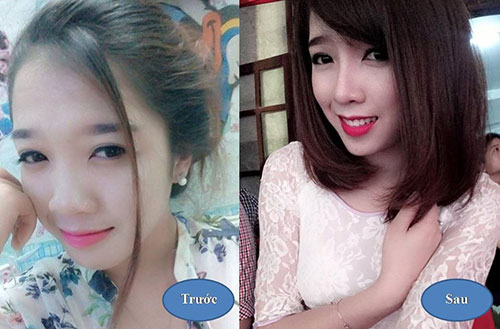 nang-mui-s-line-3d-xu-huong-tham-hot-han-quoc-2016