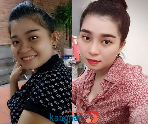 Sau khi nang mui bao lau moi duoc quan he