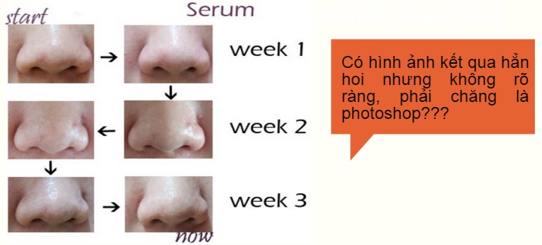 Serum nâng mũi có tốt không là mối quan tâm của nhiều người