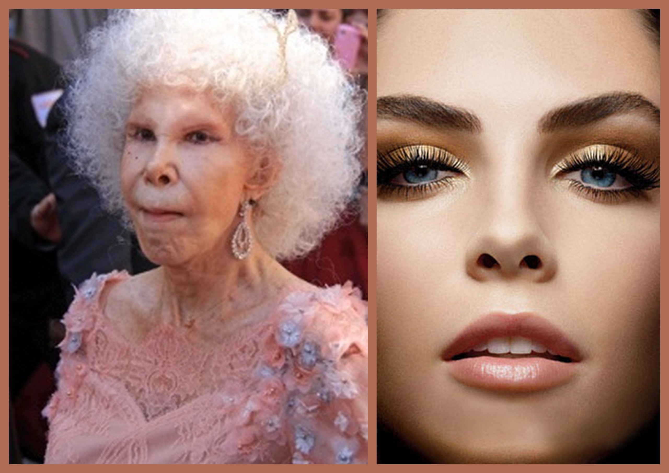 Nâng mũi xưa – nay, những điều khác biệt