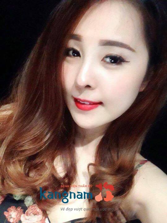 Top 2 xu hướng nâng mũi HOT 2017 khuấy đảo thị trường thẩm mỹ Việt Nam