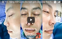 [Livestream] Nâng mũi L line cho nam cùng Ekip thực hiện cho Đức Phúc