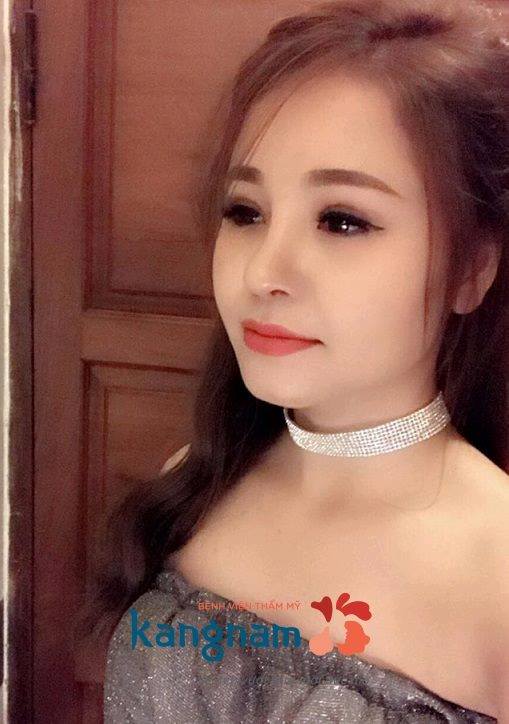 Cách làm mũi cao lên