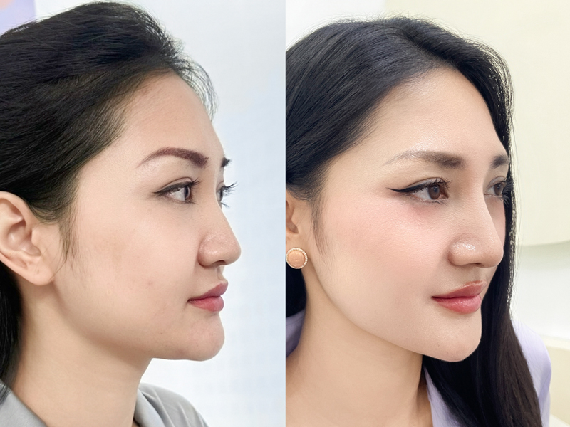 Những cơ sở thẩm mỹ uy tín mỗi năm đón lượt khách hàng làm đẹp lớn