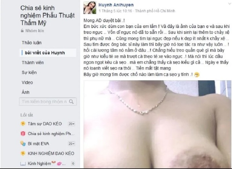 Khách hàng bóc phốt cơ sở thẩm mỹ phẫu thuật hỏng