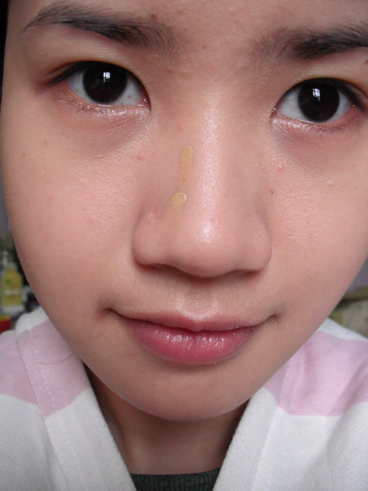 “Cải mệnh” nhờ công nghệ nâng mũi S line 3D