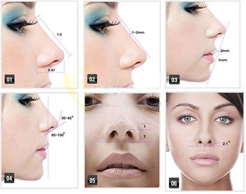 Công nghệ nâng mũi S-line 3D tạo dáng mũi đẹp mọi góc nhìn