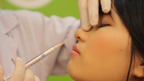 Chi phí nâng mũi không cần phẫu thuật bao nhiêu tiền?