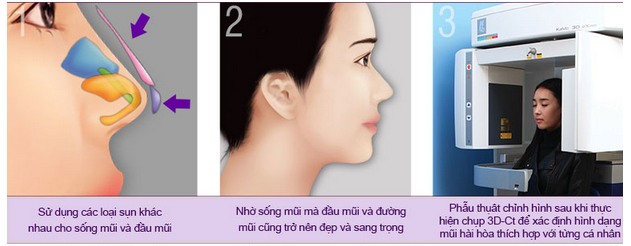 Dáng mũi đẹp như ý với công nghệ S-line 3D