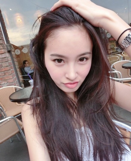 Nâng mũi Kangnam’s Perfect Sline có đau không?