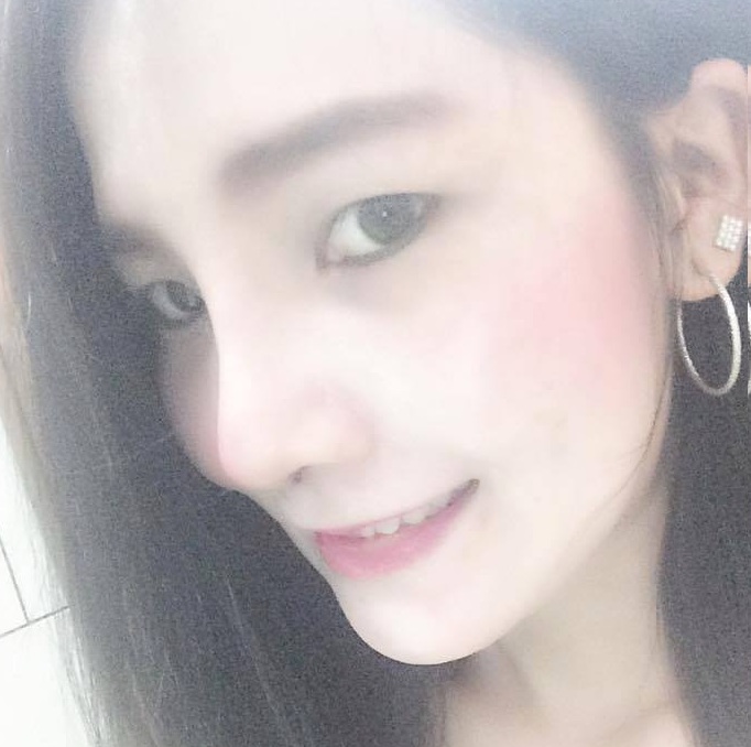 Mũi bị lệch có chỉnh sửa được không?